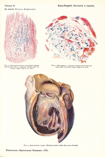 Инфекционные болезни. С 64 рисунками в тексте и цветными таблицами. В 2 т., в 4 ч. Т. 1-2. Пг.: Практическая медицина, 1914.